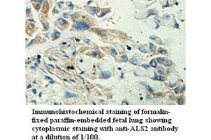 Image no. 1 for anti-Amyotrophic Lateral Sclerosis 2 (Juvenile) (ALS2) antibody (ABIN1574645) (ALS2 Antikörper)