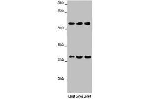 Western blot All lanes: MAOB antibody at 9 μg/mL Lane 1: Mouse liver tissue Lane 2: HepG2 whole cell lysate Lane 3: A549 whole cell lysate Secondary Goat polyclonal to rabbit IgG at 1/10000 dilution Predicted band size: 59, 47 kDa Observed band size: 59, 27 kDa (Monoamine Oxidase B Antikörper  (AA 2-489))