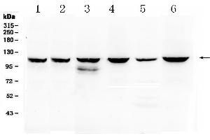 Western blot analysis of PIK3CB using anti- PIK3CB antibody . (PIK3CB Antikörper  (Middle Region))