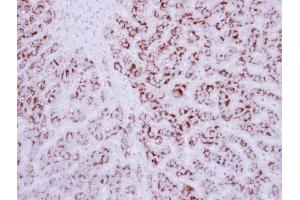 IHC-P Image Immunohistochemical analysis of paraffin-embedded human breast cancer, using EDIL3, antibody at 1:250 dilution. (EDIL3 Antikörper  (Center))