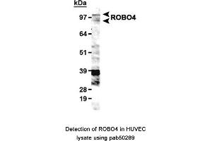 Image no. 1 for anti-Roundabout, Axon Guidance Receptor, Homolog 4 (ROBO4) (AA 900-1007), (C-Term) antibody (ABIN363598) (ROBO4 Antikörper  (C-Term))