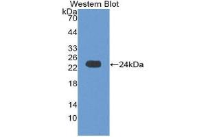 Western Blotting (WB) image for anti-Crystallin, alpha B (CRYAB) (AA 1-175) antibody (ABIN1867399)