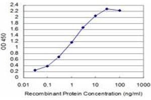 Detection limit for recombinant GST tagged SIX4 is approximately 0. (SIX4 Antikörper  (AA 672-780))