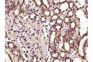 Paraformaldehyde-fixed, paraffin embedded rat kidney, Antigen retrieval by boiling in sodium citrate buffer (pH6) for 15min, Block endogenous peroxidase by 3% hydrogen peroxide for 30 minutes,  Blocking buffer (normal goat serum) at 37°C for 20min, Antibody incubation with HDAC6 Polyclonal Antibody (bs-2811R) at 1:400 overnight at 4°C, followed by a conjugated secondary and DAB staining. (HDAC6 Antikörper  (AA 301-400))