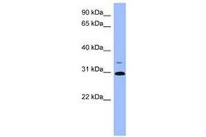 Image no. 1 for anti-Phosphoserine Phosphatase (PSPH) (AA 71-120) antibody (ABIN6741801) (PSPH Antikörper  (AA 71-120))