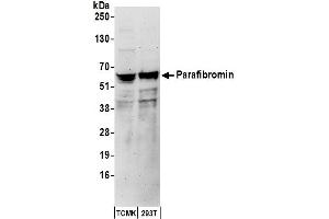 anti-Parafibromin (CDC73) (AA 250-300) antibody