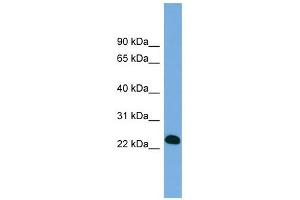 BCL7A antibody used at 1 ug/ml to detect target protein. (BCL7A Antikörper  (Middle Region))