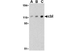 Western blot analysis of cbl in Daudi cell lysate with AP30209PU-N cbl antibody at (A) 0. (CBL Antikörper  (C-Term))
