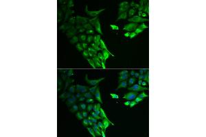 Immunofluorescence analysis of A549 cells using HABP2 antibody. (HABP2 Antikörper)