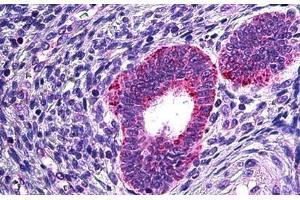 Human Uterus: Formalin-Fixed, Paraffin-Embedded (FFPE) (PLA2G4A Antikörper  (AA 153-166))