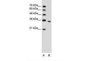 Image no. 1 for anti-phosphoribosyl Pyrophosphate Synthetase 2 (PRPS2) (N-Term) antibody (ABIN203391) (PRPS2 Antikörper  (N-Term))
