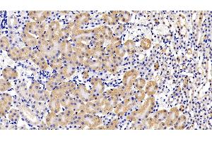 Detection of LIFR in Mouse Kidney Tissue using Polyclonal Antibody to Leukemia Inhibitory Factor Receptor (LIFR) (LIFR Antikörper  (AA 151-290))