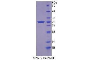 Image no. 1 for Casein kappa (CSN3) (AA 24-181) protein (His tag) (ABIN6237588)