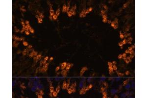 Immunofluorescence analysis of Rat testis using OXCT2 Polyclonal Antibody at dilution of 1:100. (OXCT2 Antikörper)