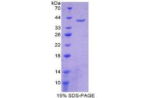 SDS-PAGE (SDS) image for Mitochondrially Encoded NADH Dehydrogenase 1 (MT-ND1) (AA 186-270) protein (His tag,GST tag) (ABIN1879597)