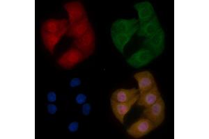 MeCP2 Mouse Monoclonal Antibody staining Hela cells by IF/ICC. (MECP2 Antikörper  (C-Term))