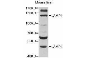 Western blot analysis of extracts of mouse liver, using LAMP1 antibody (ABIN5998110) at 1/500 dilution. (LAMP1 Antikörper)