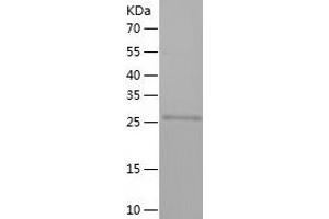Western Blotting (WB) image for Zinc Finger Protein 346 (ZNF346) (AA 1-294) protein (His tag) (ABIN7125788) (ZNF346 Protein (AA 1-294) (His tag))