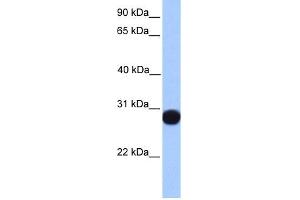 WB Suggested Anti-PRDX6 Antibody Titration:  0. (Peroxiredoxin 6 Antikörper  (C-Term))