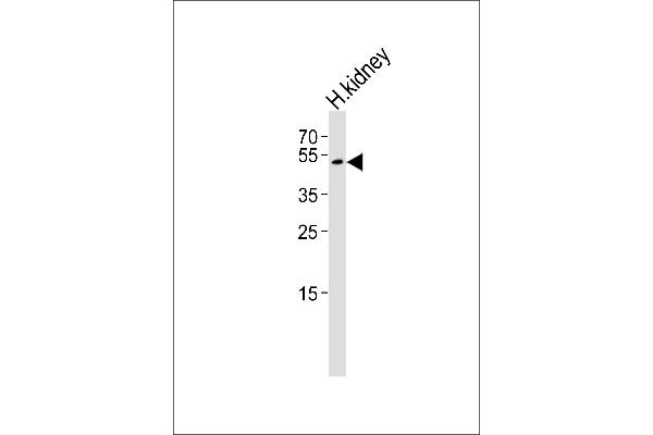 FOLH1B Antikörper  (AA 155-183)