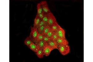 IF analysis of BRD2 and Tubulin beta using anti-BRD2 antibody (ABIN7599091) and anti-Tubulin beta antibody (ABIN7602744).