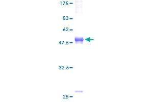 Image no. 1 for Triggering Receptor Expressed On Myeloid Cells 2 (TREM2) (AA 1-222) protein (GST tag) (ABIN1323574) (TREM2 Protein (AA 1-222) (GST tag))
