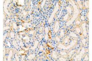 ABIN6264924 and ABIN6279466 at 1/100 staining Rat kidney tissue by IHC-P. (SAR1A Antikörper  (Internal Region))