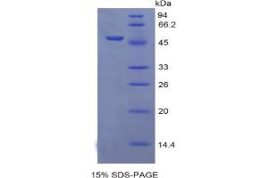 SDS-PAGE analysis of Rat EGFR2 Protein. (EGFR2 Protein)