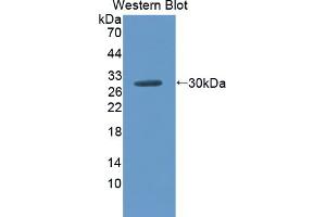 Figure. (SCNN1G Antikörper  (AA 1-182))