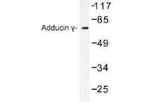 Image no. 1 for anti-Adducin 3 (Gamma) (ADD3) antibody (ABIN272287) (ADD3 Antikörper)