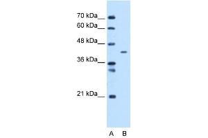 MTCH1 antibody used at 1 ug/ml to detect target protein. (MTCH1 Antikörper)