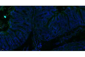 Paraformaldehyde-fixed, paraffin embedded Rat colon; Antigen retrieval by boiling in sodium citrate buffer (pH6. (MTM1 Antikörper  (AA 225-275))