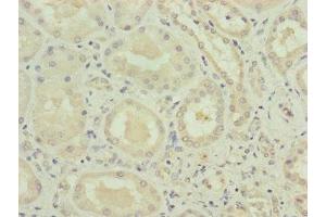 Immunohistochemistry of paraffin-embedded human kidney tissue using ABIN7175282 at dilution of 1:100 (VPS11 Antikörper  (AA 692-941))