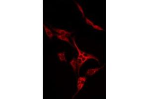 Immunofluorescence (fixed cells) (IF/ICC) image for anti-Solute Carrier Family 7 (Cationic Amino Acid Transporter, Y+ System), Member 4 (SLC7A4) (C-Term) antibody (ABIN6257777)