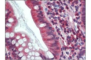 Human Small Intestine: Formalin-Fixed, Paraffin-Embedded (FFPE) (CA1 Antikörper  (Internal Region))