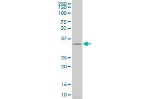 SIX3 monoclonal antibody (M02), clone 3F1 Western Blot analysis of SIX3 expression in 293 . (SIX3 Antikörper  (AA 273-332))