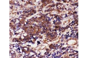 Immunohistochemistry (IHC) image for anti-Caspase 3 (CASP3) (AA 67-175) antibody (ABIN3030302)