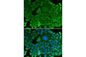 Immunofluorescence analysis of HeLa cells using RhoGDI antibody (ABIN3021743, ABIN3021744, ABIN3021745 and ABIN1512595). (ARHGDIA Antikörper  (AA 1-204))