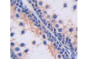 IHC-P analysis of Human Tissue, with DAB staining. (SLC2A14 Antikörper  (AA 230-293))