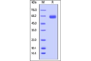 SDS-PAGE (SDS) image for Receptor Tyrosine Kinase-Like Orphan Receptor 1 (ROR1) (AA 30-403) protein (His tag) (ABIN5526632)