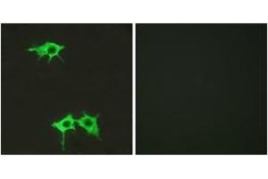Immunofluorescence analysis of LOVO cells, using FZD4 Antibody. (FZD4 Antikörper  (AA 131-180))