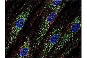 Immunofluorescence staining of human skin fibroblasts with anti-CD63 (MEM-259 ; green) after co-incubation of living cells with human Transferrin - Dyomics 547; cell nuclei stained with DAPI (blue). (CD63 Antikörper  (PerCP))