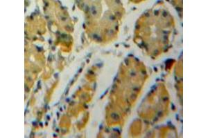 Used in DAB staining on fromalin fixed paraffin-embedded Stomach tissue (ENO1 Antikörper  (AA 1-434))