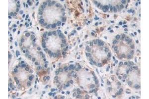 Immunohistochemistry (IHC) image for anti-Suppressor of Cytokine Signaling 2 (SOCS2) (AA 1-198) antibody (ABIN7443314)