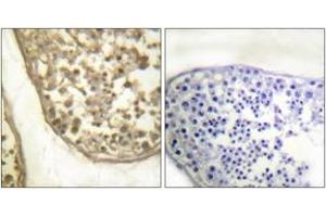 Immunohistochemistry analysis of paraffin-embedded human testis, using c-Jun (Phospho-Thr231) Antibody. (C-JUN Antikörper  (pThr231))
