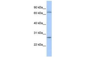 Image no. 1 for anti-Ring Finger and CHY Zinc Finger Domain Containing 1, E3 Ubiquitin Protein Ligase (RCHY1) (AA 36-85) antibody (ABIN6743138)