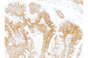Immunohistochemistry (IHC) image for anti-Oxidized Low Density Lipoprotein (Lectin-Like) Receptor 1 (OLR1) (AA 61-273) antibody (ABIN7795657) (Rekombinanter OLR1 Antikörper  (AA 61-273))