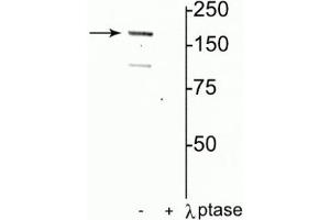 Western blot of rat hippocampal lysate showing specific immunolabeling of the ~180 kDa NR2A subunit of the NMDAR phosphorylated at Tyr1325 in the first lane (-). (NMDAR2A Antikörper  (pTyr1325))