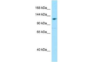 WB Suggested Anti-GRID2IP Antibody Titration: 1. (GRID2IP Antikörper  (Middle Region))