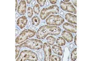 Immunohistochemistry (IHC) image for anti-G protein beta subunit-like (GBL) (AA 1-326) antibody (ABIN6143894)